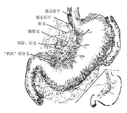 Glz5276r.jpg