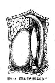 Bka56.jpg