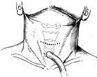 Bka83.jpg
