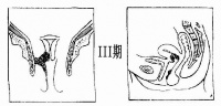 Bk8a1.jpg