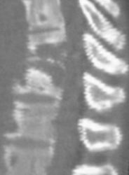 Bkm5m.jpg