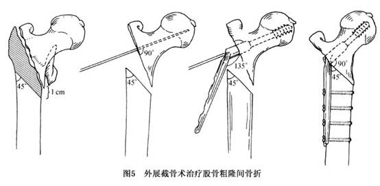 Gxpyd906.jpg