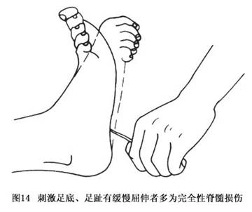 Gxqa3vmq.jpg