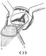 Bk98b.jpg