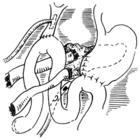 Bkm5b.jpg
