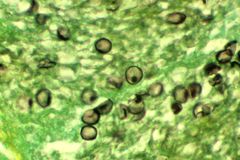 P. jirovecii