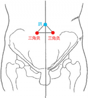 经外奇穴——三角灸的位置