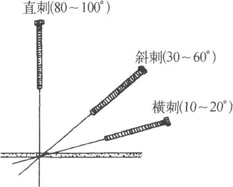 常用针刺角度示意图