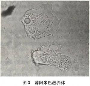 棘阿米巴滋养体