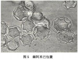 棘阿米巴包囊