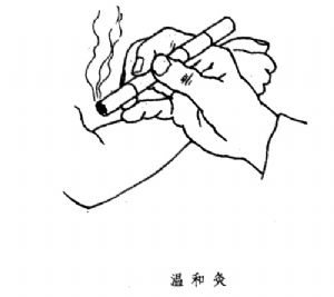 温和灸示意图