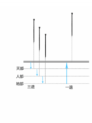 三进一退/一退三进