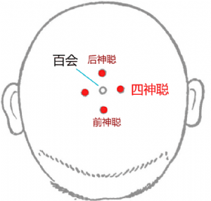 經外奇穴——四神聰的位置
