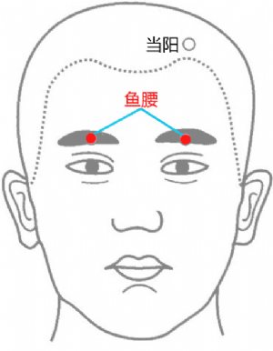 經外奇穴——魚腰穴的位置