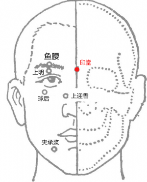 印堂穴的位置