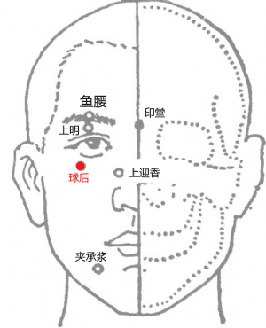 经外奇穴——球后穴的位置 经外奇穴——球后穴的位置