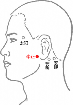 經外奇穴——牽正的位置