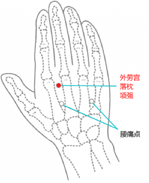 外勞宮（落枕、項強）的位置