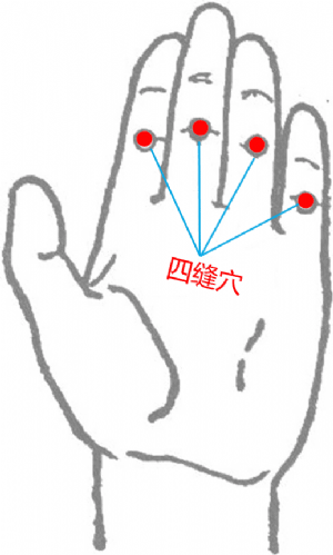 經外奇穴——四縫穴的位置