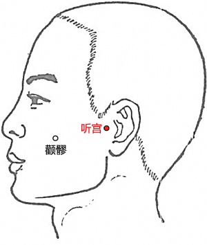 聽宮穴的位置.png