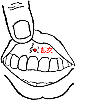 龈交穴在齿龈部的位置