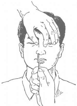 鼻骨骨折復位法