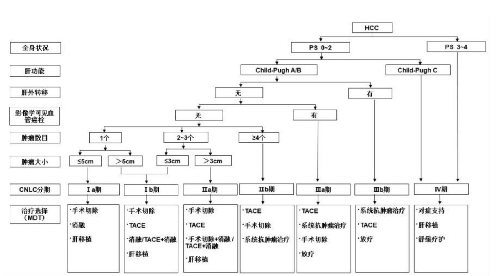 中國肝癌臨牀分期與治療路線圖