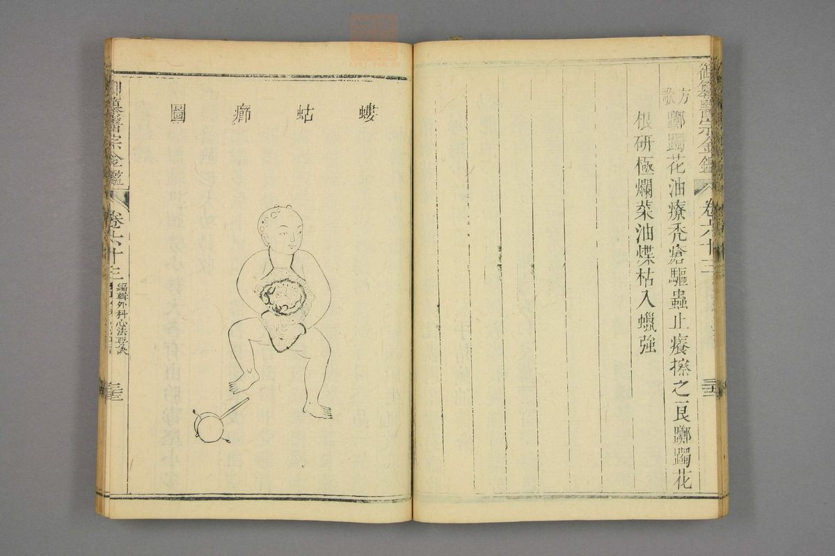 御纂医宗金鉴(第3069页)