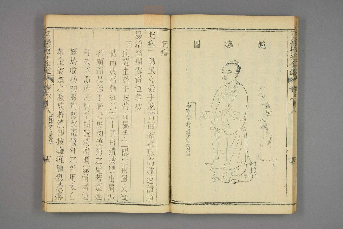 御纂医宗金鉴(第3395页)