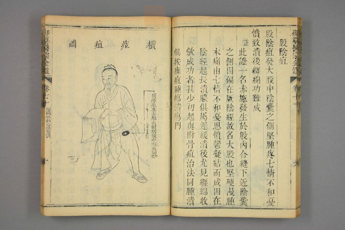 御纂医宗金鉴(第3485页)