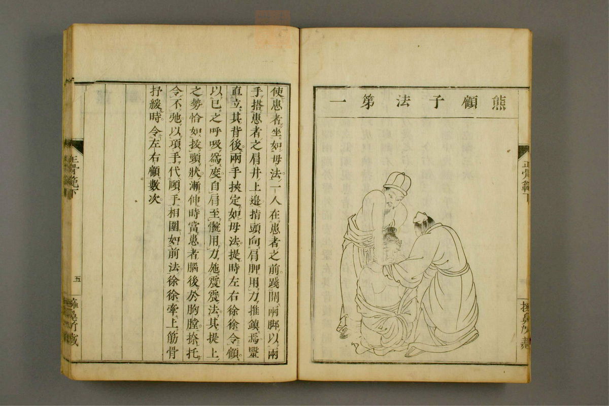 正骨范(第55页)