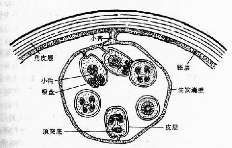棘球蚴及生发囊模式图(仿Morseth)
