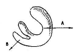 左右心室除极综合向量(CD)