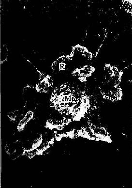 大鼠分离肝巨噬细胞粘着吞噬羊红细胞扫描电镜像