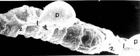 毛细血管　扫描电镜像示周细胞