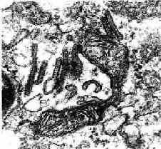 郎格汉斯细胞电镜像