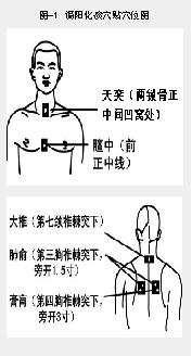 温阳化痰穴贴可防治呼吸道疾病