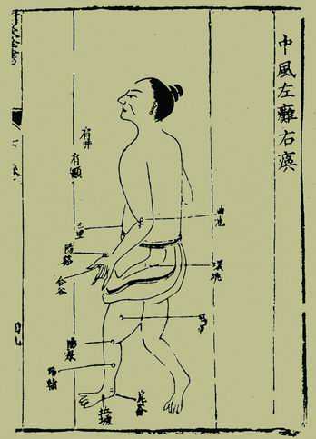 《杨敬斋针灸全书》