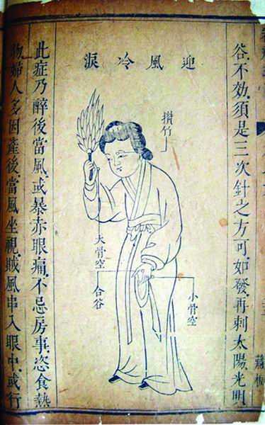 《审视瑶函》
