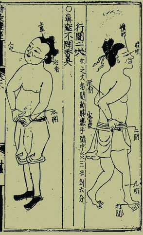 《针灸捷径》