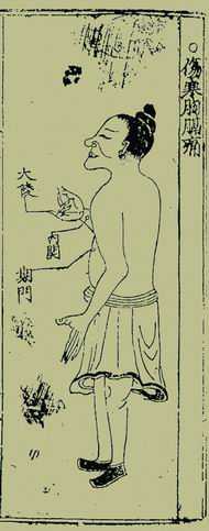《针灸捷径》 