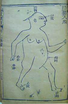 《针灸便用》 