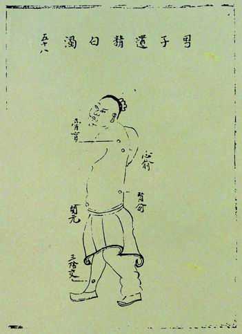 《针灸问答》