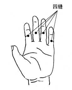 图8-1-2四缝