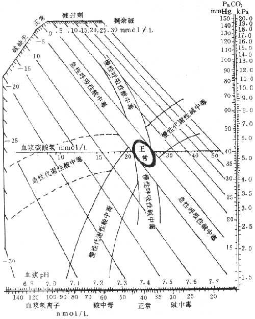各种类型酸碱平衡紊乱时血浆pH、Pco2、HCO3- 变化示意图