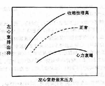 心功能曲线示意图