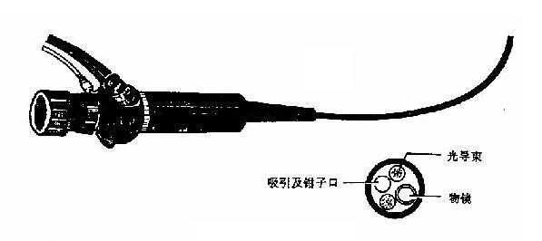纤维喉镜