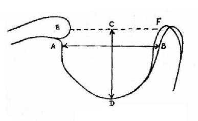 蝶鞍大小之测量
