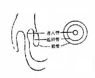 肠套迭层次示意图