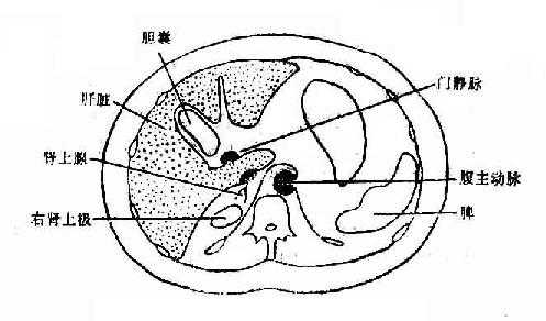 腹部横断层面图象